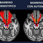 Autismo e deficit della ricompensa sociale